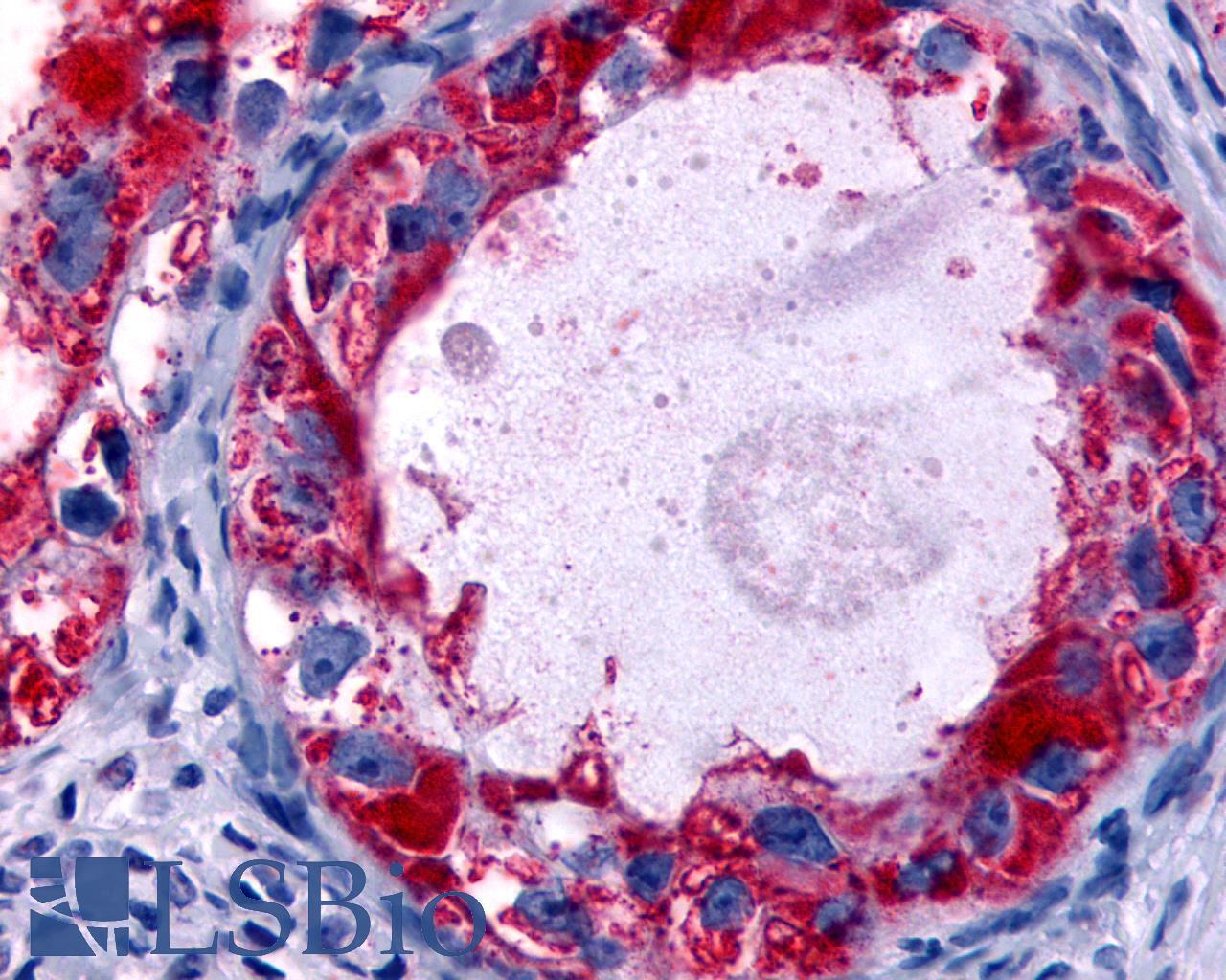 HRH4 / Histamine H4 Receptor Antibody - Ovary, carcinoma
