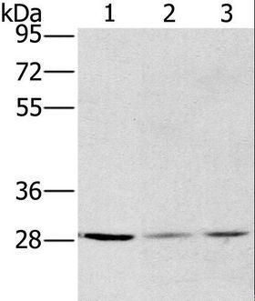 HSD17B12 Antibody - Western blot analysis of A375, HeLa and A172 cell, using HSD17B12 Polyclonal Antibody at dilution of 1:570.
