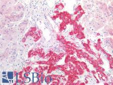 HSD17B12 Antibody - Human Adrenal: Formalin-Fixed, Paraffin-Embedded (FFPE)