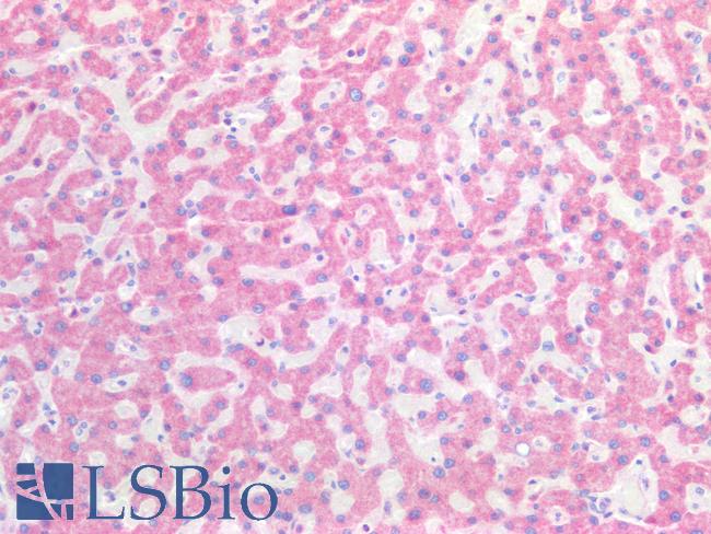 HSD17B12 Antibody - Human Liver: Formalin-Fixed, Paraffin-Embedded (FFPE)