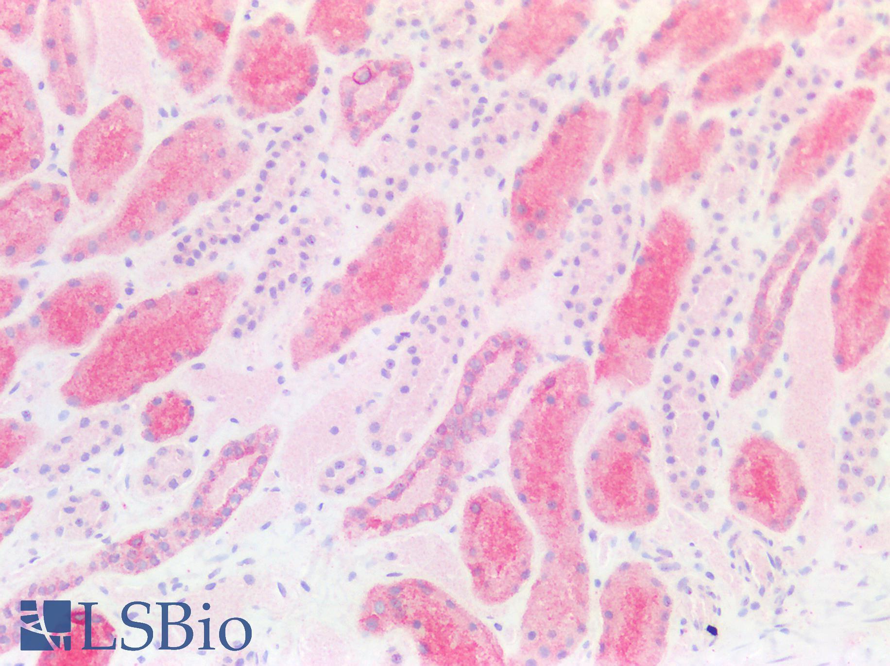 HSD3B7 Antibody - Human Kidney: Formalin-Fixed, Paraffin-Embedded (FFPE)
