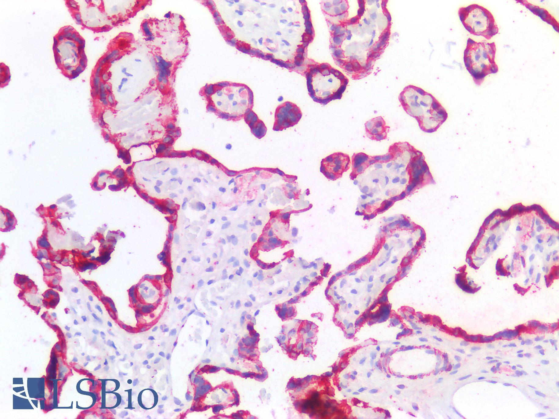 HSD3B7 Antibody - Human Placenta: Formalin-Fixed, Paraffin-Embedded (FFPE)