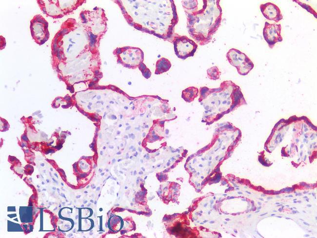 HSD3B7 Antibody - Human Placenta: Formalin-Fixed, Paraffin-Embedded (FFPE)