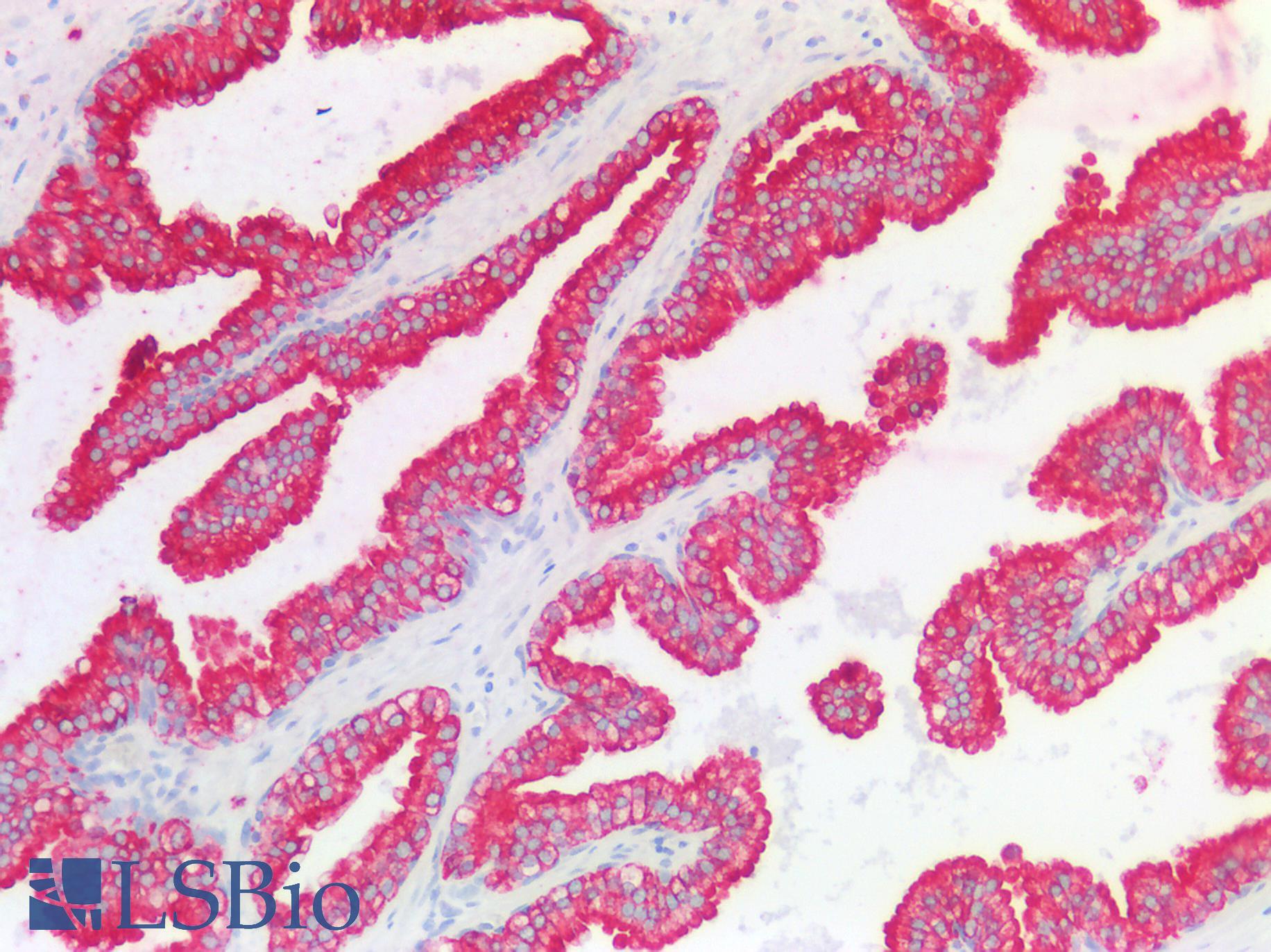 HSD3B7 Antibody - Human Prostate: Formalin-Fixed, Paraffin-Embedded (FFPE)