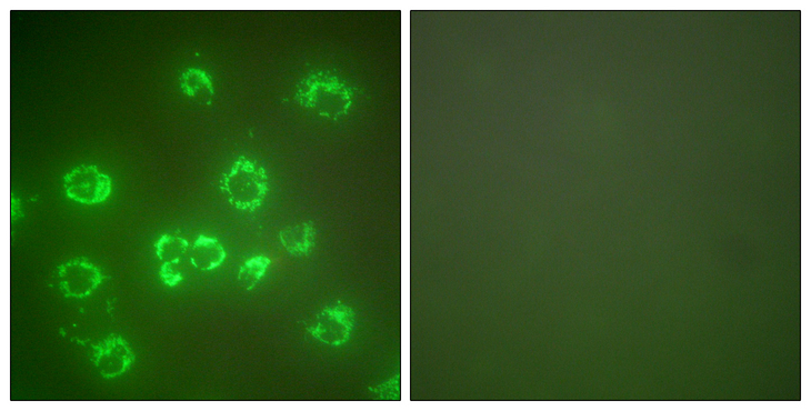 HSPA9 / Mortalin / GRP75 Antibody - Immunofluorescence analysis of COS7 cells, using GRP75 Antibody. The picture on the right is blocked with the synthesized peptide.