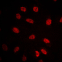 HSPA9 / Mortalin / GRP75 Antibody - Immunofluorescent analysis of GRP75 staining in NIH3T3 cells. Formalin-fixed cells were permeabilized with 0.1% Triton X-100 in TBS for 5-10 minutes and blocked with 3% BSA-PBS for 30 minutes at room temperature. Cells were probed with the primary antibody in 3% BSA-PBS and incubated overnight at 4 C in a humidified chamber. Cells were washed with PBST and incubated with a DyLight 594-conjugated secondary antibody (red) in PBS at room temperature in the dark. DAPI was used to stain the cell nuclei (blue).