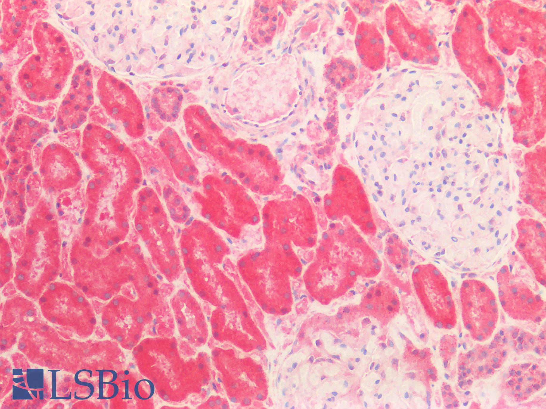 HSPA9 / Mortalin / GRP75 Antibody - Human Kidney: Formalin-Fixed, Paraffin-Embedded (FFPE)