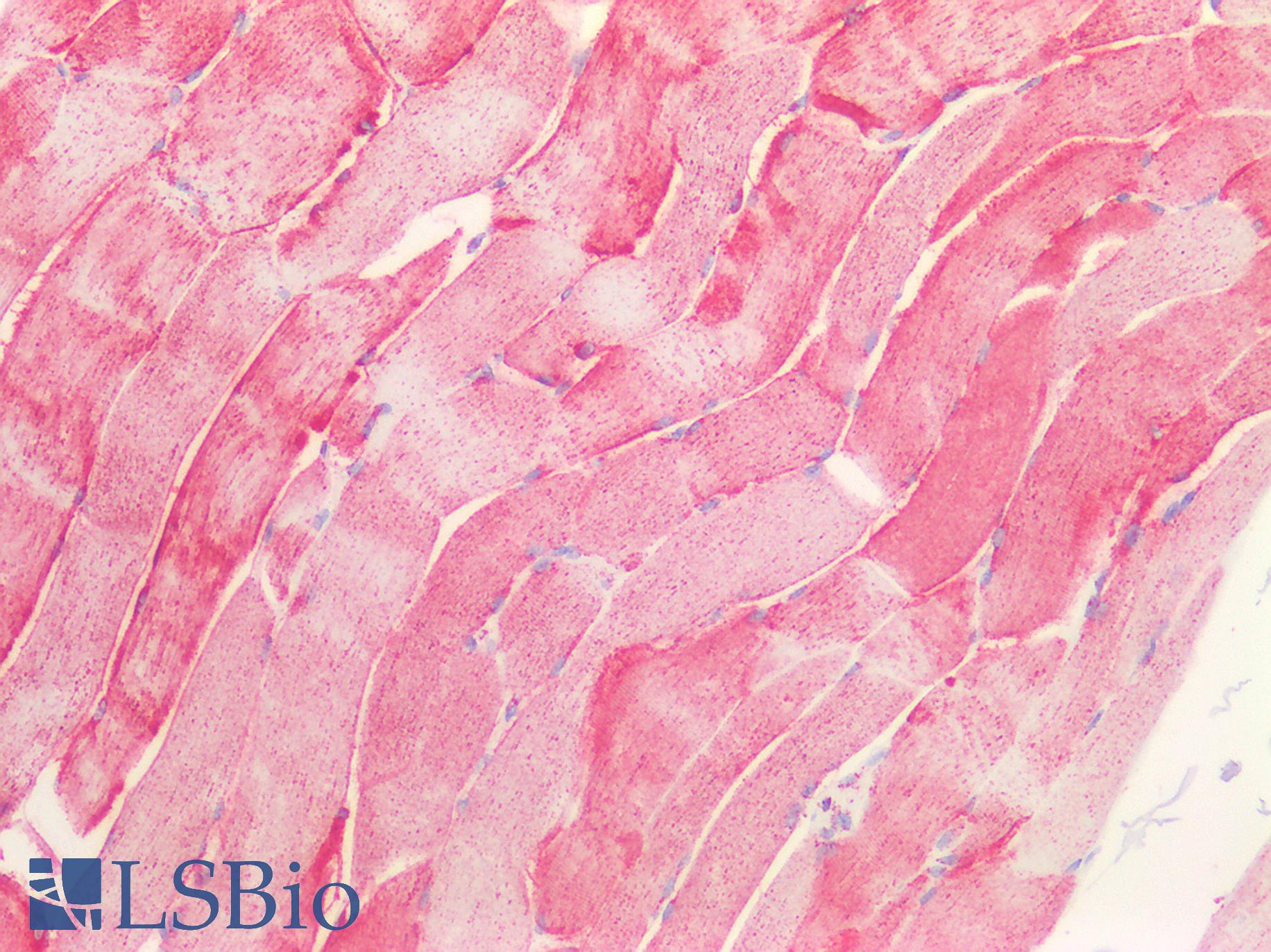 HSPA9 / Mortalin / GRP75 Antibody - Human Skeletal Muscle: Formalin-Fixed, Paraffin-Embedded (FFPE)