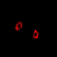 HSPA9 / Mortalin / GRP75 Antibody - Immunofluorescent analysis of GRP75 staining in U2OS cells. Formalin-fixed cells were permeabilized with 0.1% Triton X-100 in TBS for 5-10 minutes and blocked with 3% BSA-PBS for 30 minutes at room temperature. Cells were probed with the primary antibody in 3% BSA-PBS and incubated overnight at 4 deg C in a humidified chamber. Cells were washed with PBST and incubated with a DyLight 594-conjugated secondary antibody (red) in PBS at room temperature in the dark.