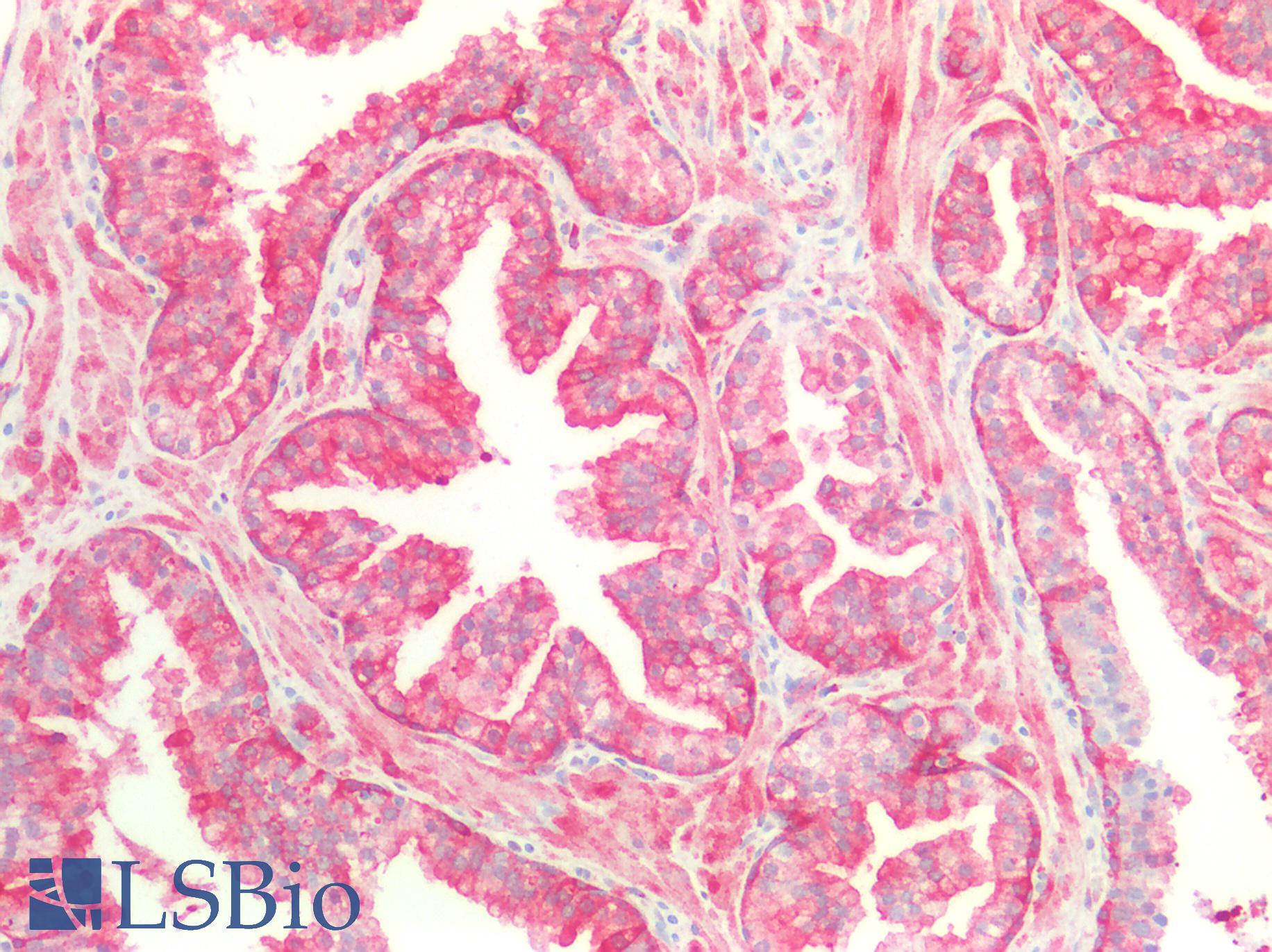 HSPB1 / HSP27 Antibody - Human Prostate: Formalin-Fixed, Paraffin-Embedded (FFPE)