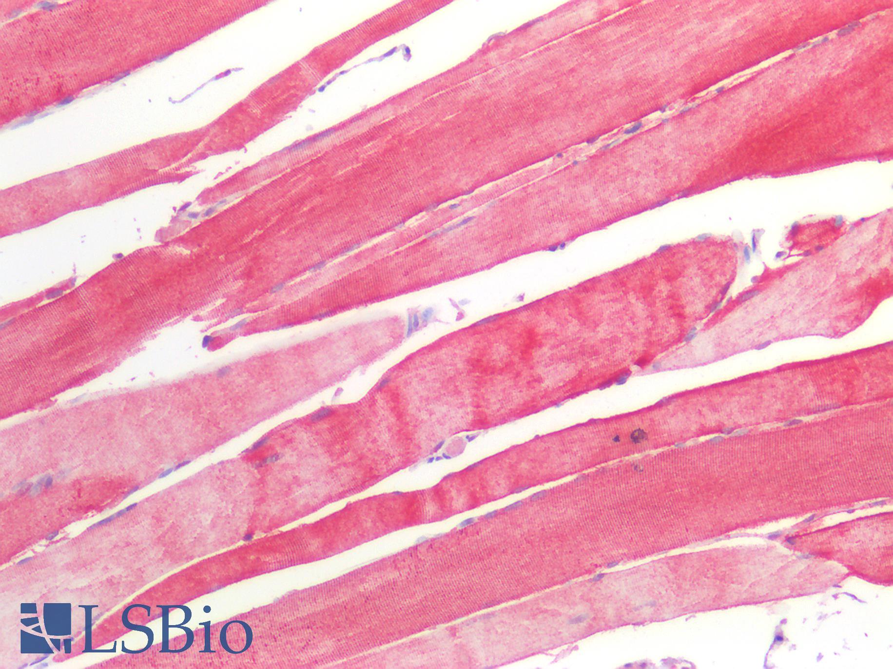 HSPB1 / HSP27 Antibody - Human Skeletal Muscle: Formalin-Fixed, Paraffin-Embedded (FFPE)