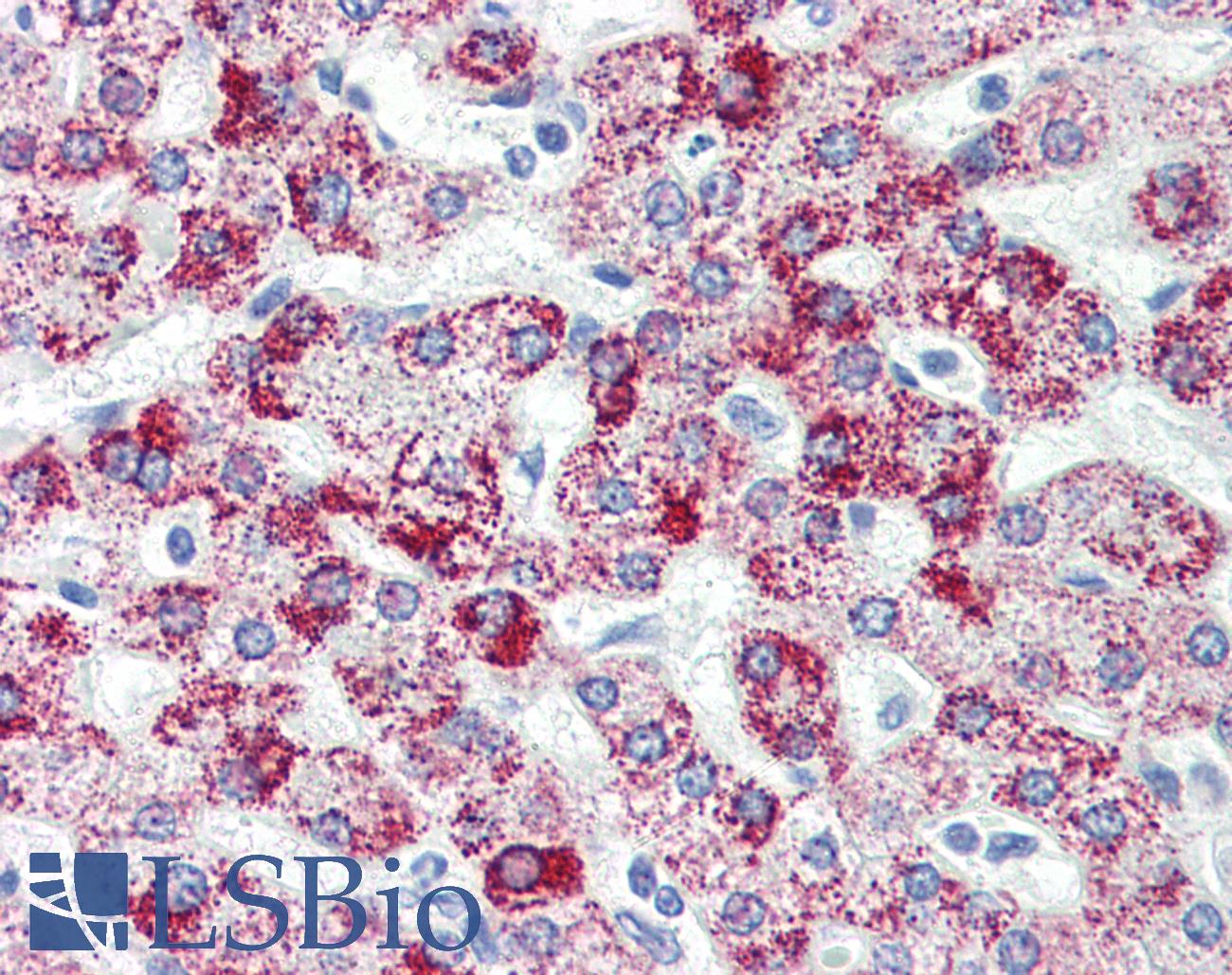 HSPD1 / HSP60 Antibody - Anti-HSPD1 antibody IHC of human liver. Immunohistochemistry of formalin-fixed, paraffin-embedded tissue after heat-induced antigen retrieval. Antibody concentration 10 ug/ml.