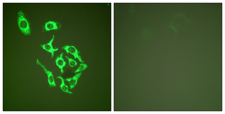 HSPD1 / HSP60 Antibody - Immunofluorescence analysis of HepG2 cells, using HSP60 Antibody. The picture on the right is blocked with the synthesized peptide.