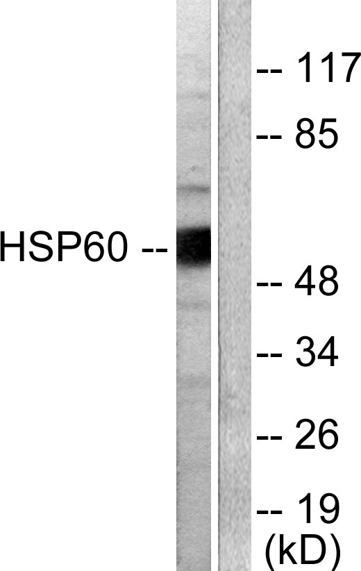 HSPD1 / HSP60 Antibody - Western blot analysis of lysates from COLO205 cells, using HSP60 Antibody. The lane on the right is blocked with the synthesized peptide.