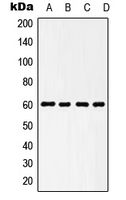 HSPD1 / HSP60 Antibody - Western blot analysis of HSP60 expression in HeLa (A); NIH3T3 (B); KNRK (C); L929 (D) whole cell lysates.