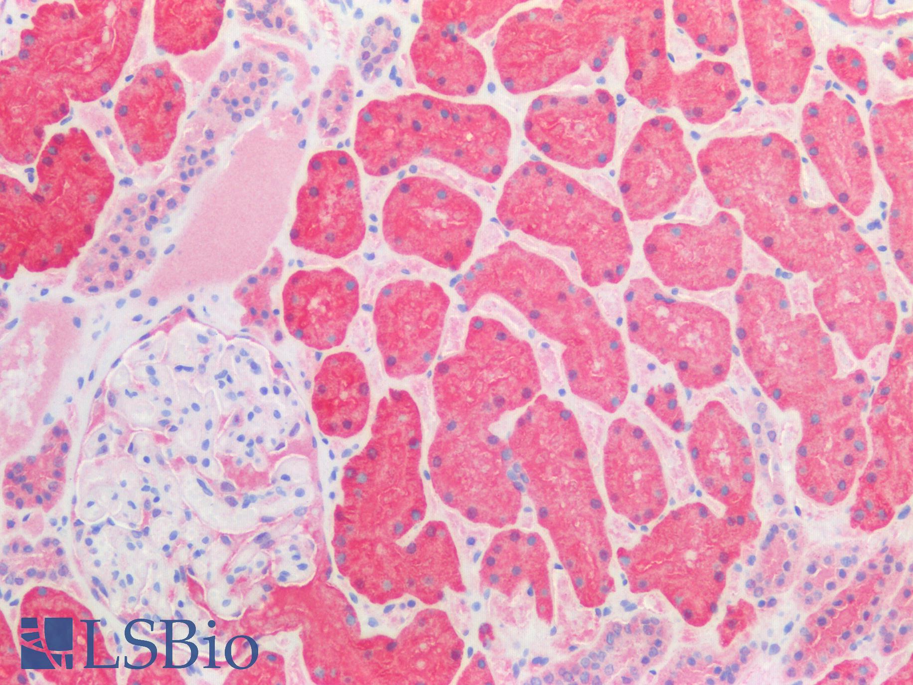 HSPD1 / HSP60 Antibody - Human Kidney: Formalin-Fixed, Paraffin-Embedded (FFPE)