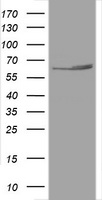 HSPD1 / HSP60 Antibody - HEK293T cells were transfected with the pCMV6-ENTRY control (Left lane) or pCMV6-ENTRY HSPD1 (Right lane) cDNA for 48 hrs and lysed. Equivalent amounts of cell lysates (5 ug per lane) were separated by SDS-PAGE and immunoblotted with anti-HSPD1.
