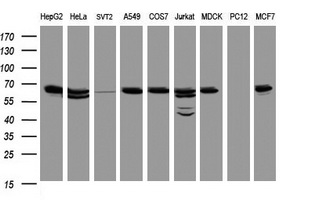 HSPD1 / HSP60 Antibody - Western blot of extracts (35 ug) from 9 different cell lines by using anti-HSPD1 monoclonal antibody (HepG2: human; HeLa: human; SVT2: mouse; A549: human; COS7: monkey; Jurkat: human; MDCK: canine; PC12: rat; MCF7: human).