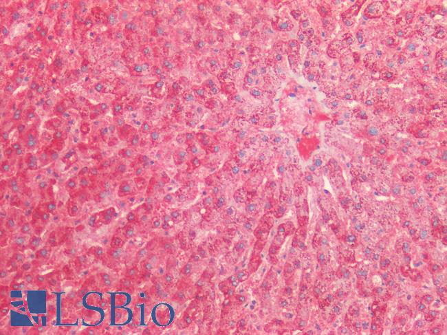 HSPD1 / HSP60 Antibody - Human Liver: Formalin-Fixed, Paraffin-Embedded (FFPE)