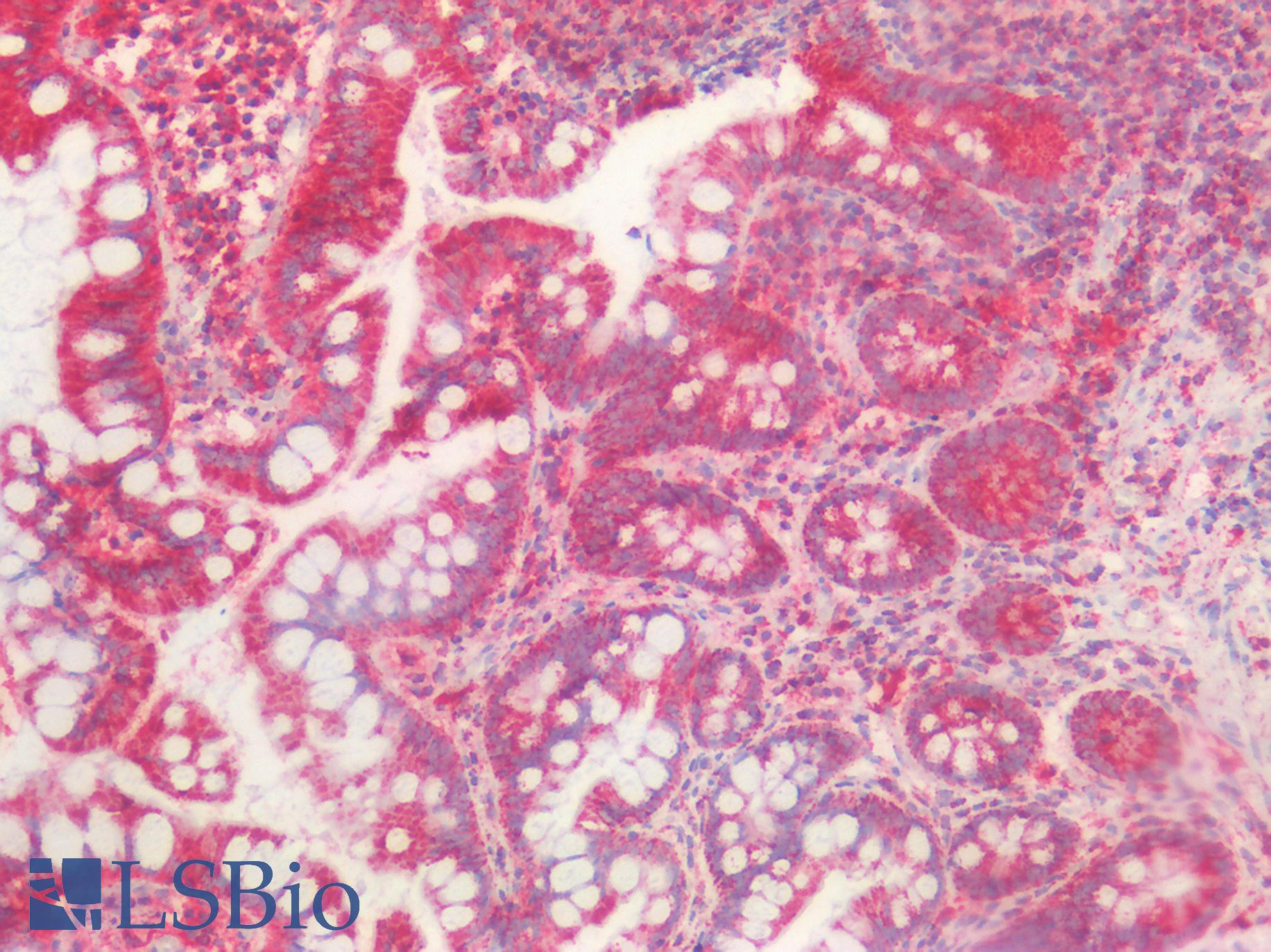 HSPD1 / HSP60 Antibody - Human Small Intestine: Formalin-Fixed, Paraffin-Embedded (FFPE)