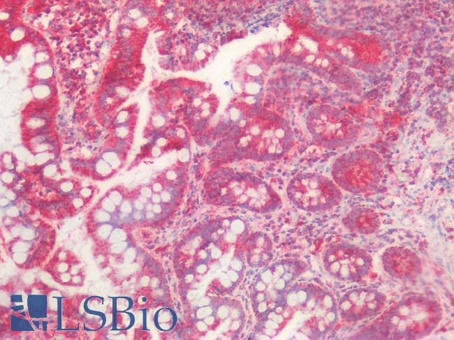 HSPD1 / HSP60 Antibody - Human Small Intestine: Formalin-Fixed, Paraffin-Embedded (FFPE)