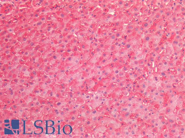 HSPD1 / HSP60 Antibody - Human Liver: Formalin-Fixed, Paraffin-Embedded (FFPE)