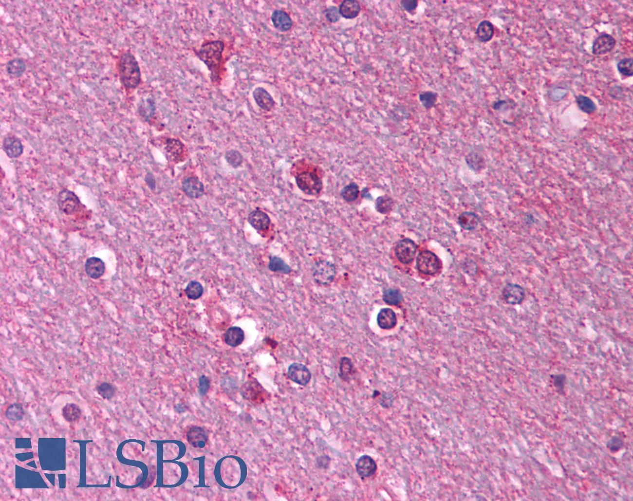 HTR1A / 5-HT1A Receptor Antibody - Anti-5HT1A Receptor antibody IHC of human brain, cortex, white matter. Immunohistochemistry of formalin-fixed, paraffin-embedded tissue after heat-induced antigen retrieval. Antibody concentration 5 ug/ml.  This image was taken for the unconjugated form of this product. Other forms have not been tested.
