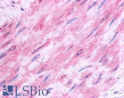 HTR1B / 5-HT1B Receptor Antibody - Anti-5HT1B Receptor antibody IHC of human vascular smooth muscle. Immunohistochemistry of formalin-fixed, paraffin-embedded tissue after heat-induced antigen retrieval.