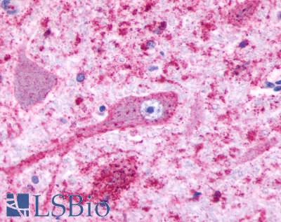HTR4 / 5-HT4 Receptor Antibody - Brain, Medulla