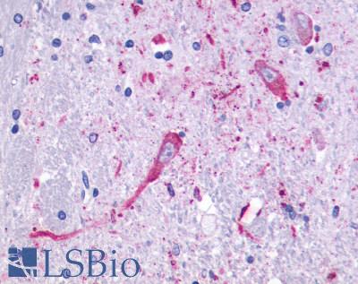HTR4 / 5-HT4 Receptor Antibody - Brain, Basal Ganglia