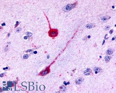 HTR6 / 5-HT6 Receptor Antibody - Brain, Basal Ganglia