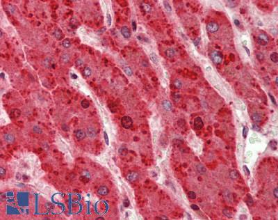 HTRA2 / OMI Antibody - Human Liver: Formalin-Fixed, Paraffin-Embedded (FFPE)