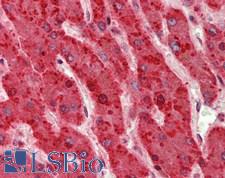 HTRA2 / OMI Antibody - Human Liver: Formalin-Fixed, Paraffin-Embedded (FFPE)