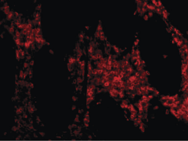HTRA2 / OMI Antibody - Immunofluorescence of OMI in human colon tissue with OMI antibody at 20 ug/ml.