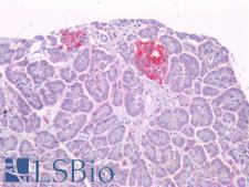 IAPP / Amylin Antibody - Human Pancreatic Islets of Langerhans: Formalin-Fixed, Paraffin-Embedded (FFPE)