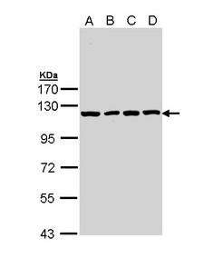 IDE Antibody - Sample (30 ug of whole cell lysate). A: A431. B: H1299. C: Hela. D: Hep G2. 7.5% SDS PAGE. IDE antibody diluted at 1:10000. 