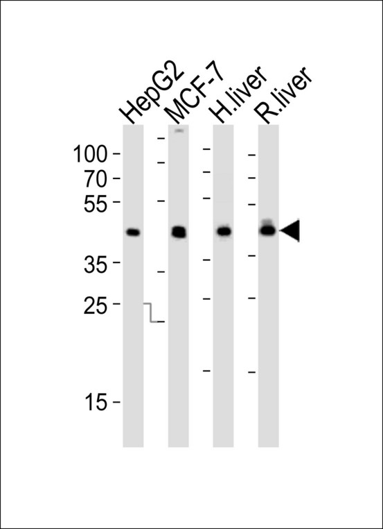 IDH1 / IDH Antibody - Western blot of lysates from HepG2, MCF-7 cell line, human liver and rat liver tissue lysate(from left to right), using IDH1 Antibody. Antibody was diluted at 1:1000 at each lane. A goat anti-rabbit IgG H&L (HRP) at 1:10000 dilution was used as the secondary antibody. Lysates at 35ug per lane.