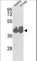 IDH1 / IDH Antibody - Western blot of IDH1 Antibody in HepG2 cell line and mouse liver tissue lysates (35 ug/lane). IDH1 (arrow) was detected using the purified antibody.