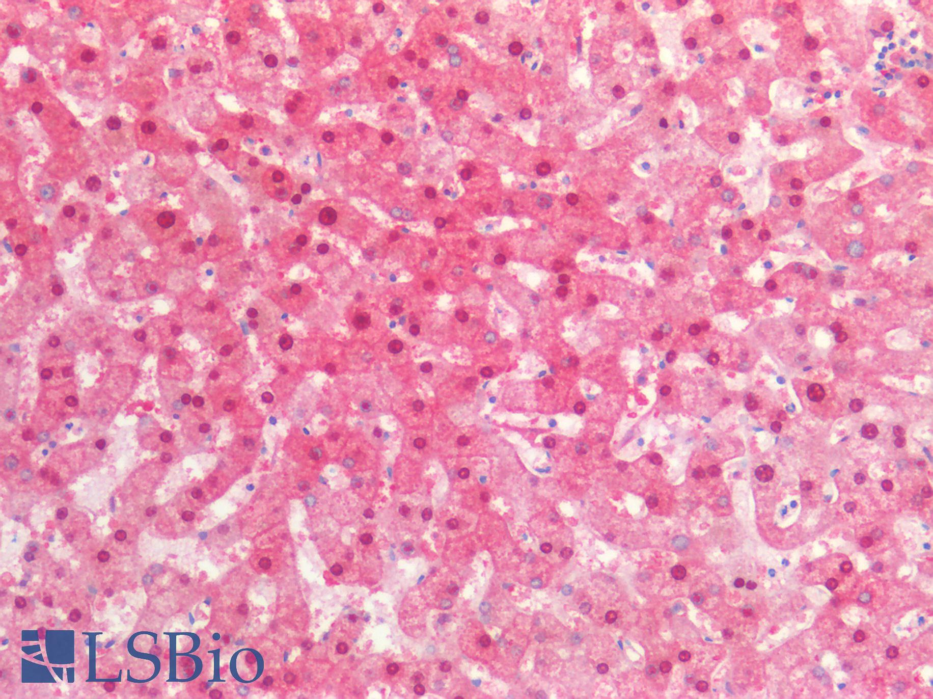 IDH1 / IDH Antibody - Human Liver: Formalin-Fixed, Paraffin-Embedded (FFPE)