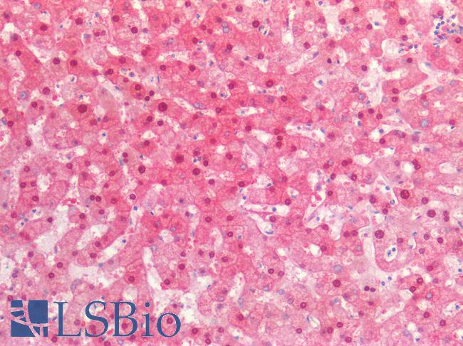 IDH1 / IDH Antibody - Human Liver: Formalin-Fixed, Paraffin-Embedded (FFPE)