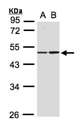 IDH1 / IDH Antibody - Sample(30 ug whole cell lysate). A: A431. B: Raji. 10% SDS PAGE. IDH1 antibody diluted at 1:1000.