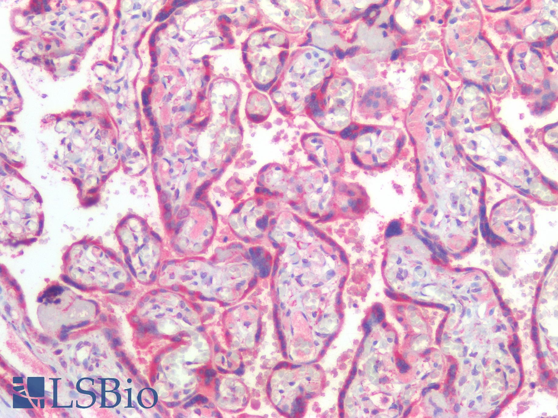 IFIH1 / MDA5 Antibody - Human Placenta: Formalin-Fixed, Paraffin-Embedded (FFPE)
