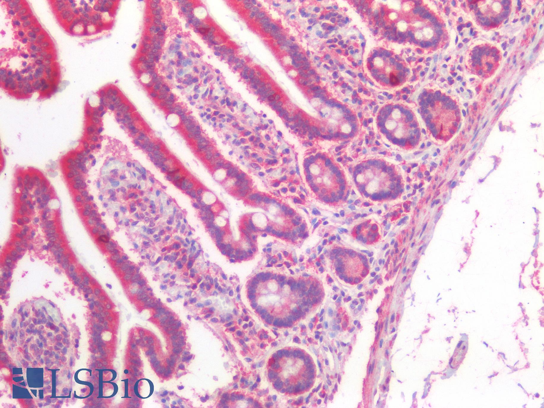 IFIH1 / MDA5 Antibody - Human Small Intestine: Formalin-Fixed, Paraffin-Embedded (FFPE)