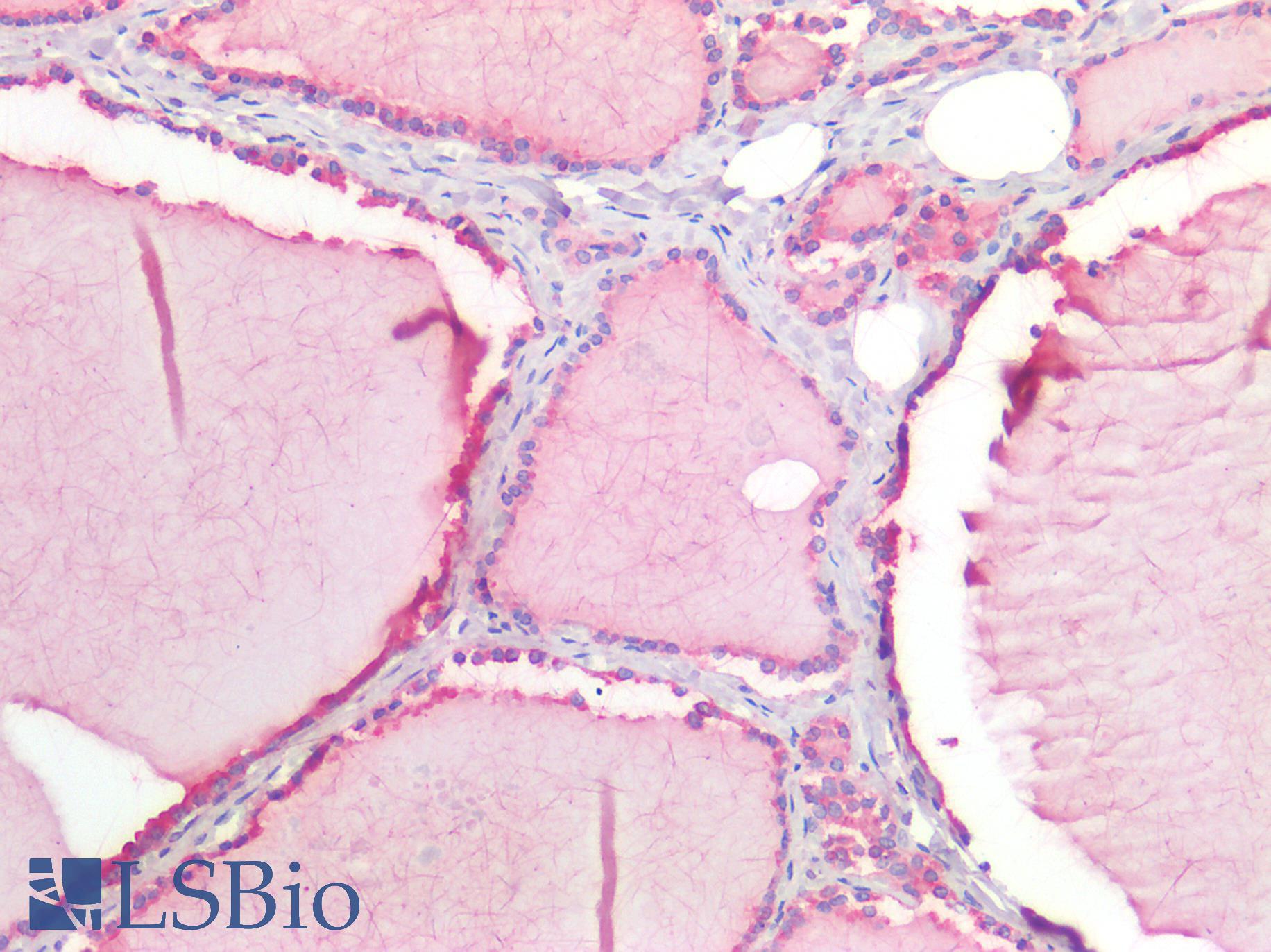 IFIH1 / MDA5 Antibody - Human Thyroid: Formalin-Fixed, Paraffin-Embedded (FFPE)