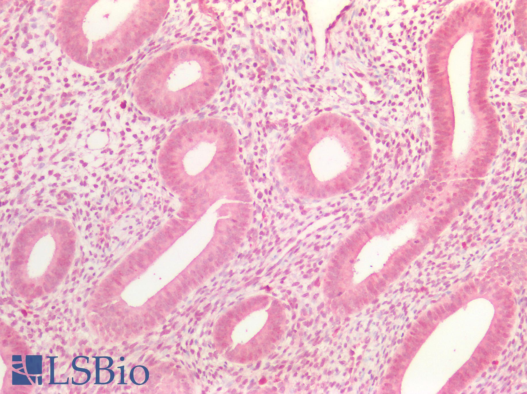 IGF2 Antibody - Human Uterus: Formalin-Fixed, Paraffin-Embedded (FFPE)
