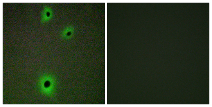 IGSF4C / CADM4 Antibody - Immunofluorescence analysis of A549 cells, using CADM4 Antibody. The picture on the right is blocked with the synthesized peptide.