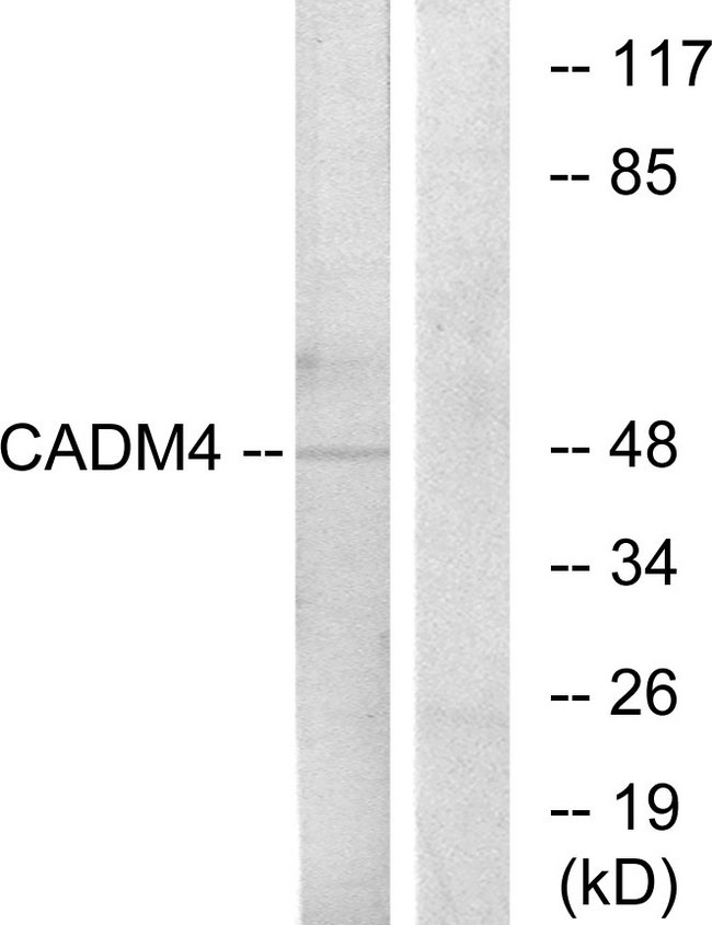 IGSF4C / CADM4 Antibody - Western blot analysis of lysates from RAW264.7 cells, using CADM4 Antibody. The lane on the right is blocked with the synthesized peptide.