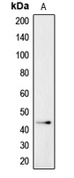 IGSF4C / CADM4 Antibody - Western blot analysis of CADM4 expression in NCIH226 (A) whole cell lysates.