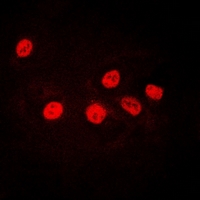 IKZF1 / IKAROS Antibody - Immunofluorescent analysis of Ikaros staining in U2OS cells. Formalin-fixed cells were permeabilized with 0.1% Triton X-100 in TBS for 5-10 minutes and blocked with 3% BSA-PBS for 30 minutes at room temperature. Cells were probed with the primary antibody in 3% BSA-PBS and incubated overnight at 4 deg C in a humidified chamber. Cells were washed with PBST and incubated with a DyLight 594-conjugated secondary antibody (red) in PBS at room temperature in the dark.