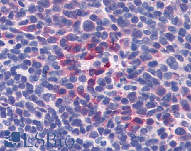 IL-10 Antibody - Anti-IL-10 antibody IHC of mouse spleen. Positive staining observed within a subset of lymphocytes.  Immunohistochemistry of formalin-fixed, paraffin-embedded tissue after heat-induced antigen retrieval. Antibody concentration 10 ug/ml.